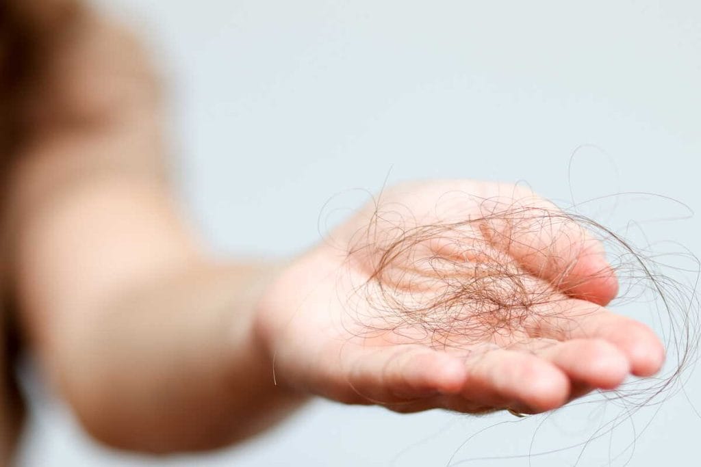 Rankoje laikomas iškritusių plaukų kuokštas, rodantis stiprų plaukų slinkimą