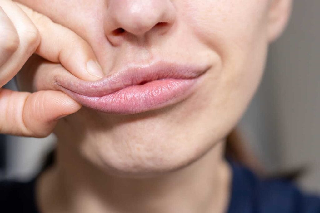 Moteris pirštais švelniai masažuoja lūpas – lūpų putlinimas namuose kartais siejamas su lengvu masažu