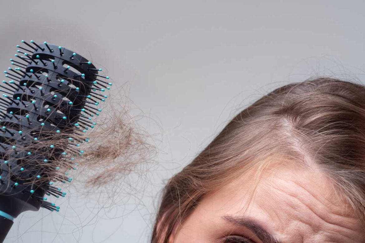 Plaukų šepetys su dideliu kiekiu iškritusių plaukų po šukavimo